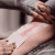 Bandages tape wound dressing