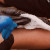 Skin preparation cleaning
